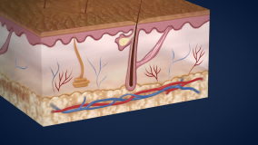 Layers of human skin and acne formation